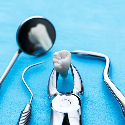 extracted tooth in pliers surrounded by other dental tools