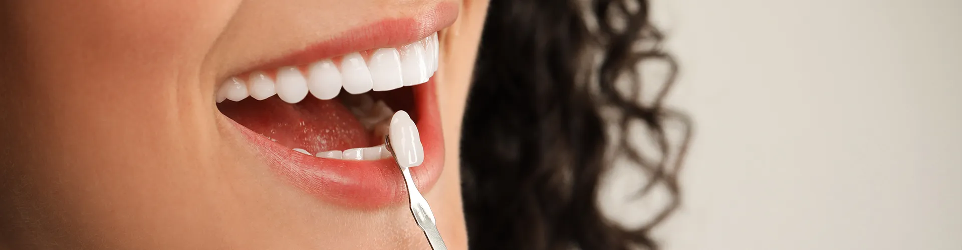 Close-up of a dentist placing a dental veneer on a patient's tooth, showcasing a cosmetic dentistry procedure for enhancing smile aesthetics.