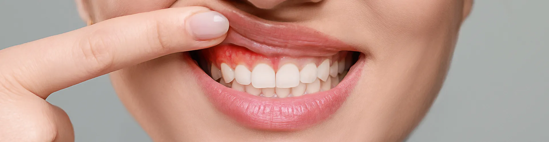 woman lifting lip to show inflamed gums