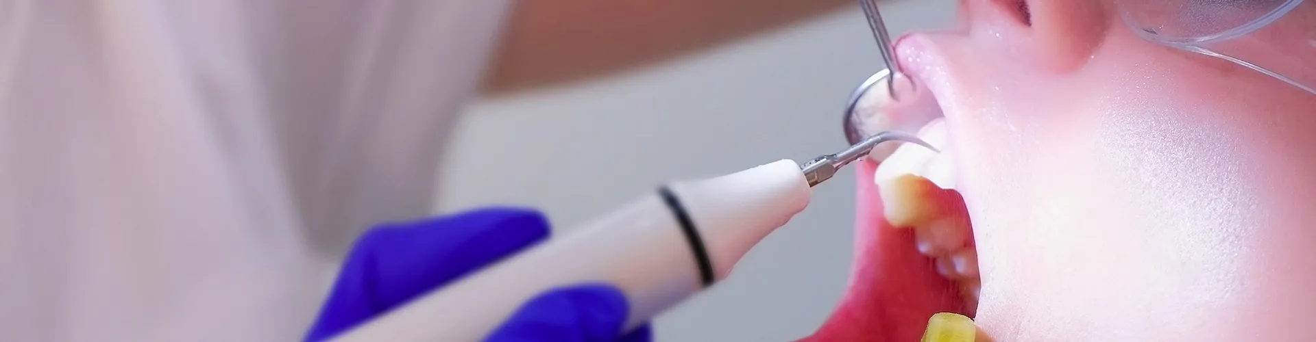 closeup of dental tools cleaning a patient's teeth