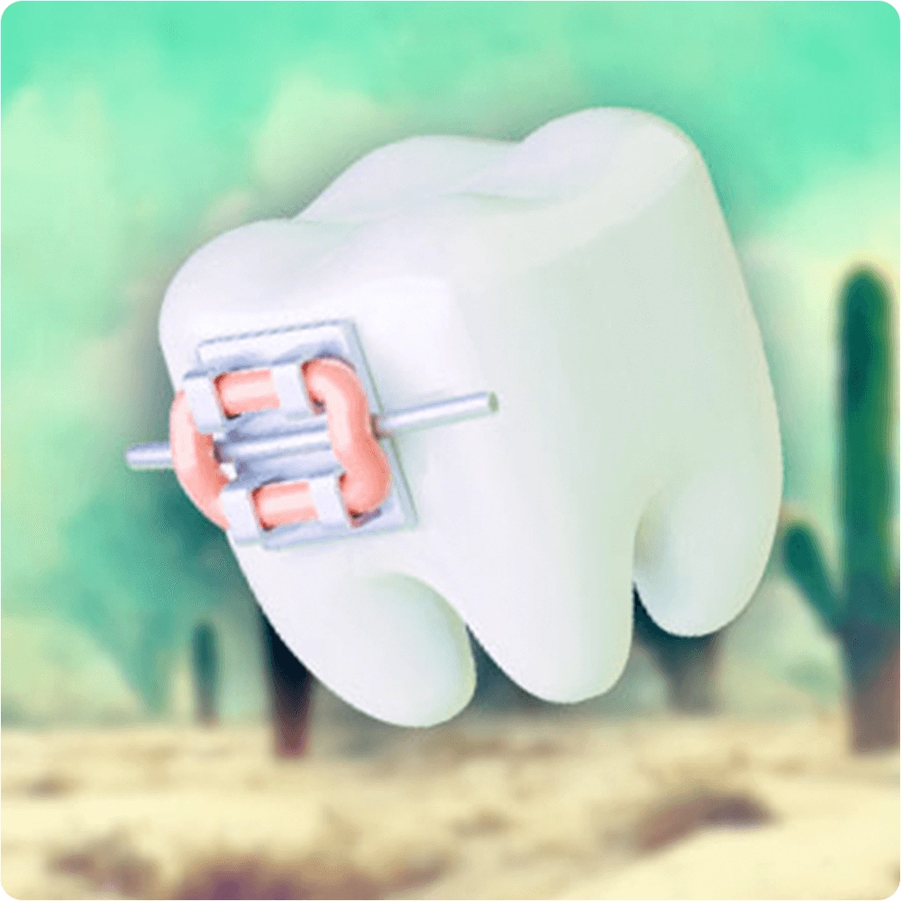 Tooth illustration with brace