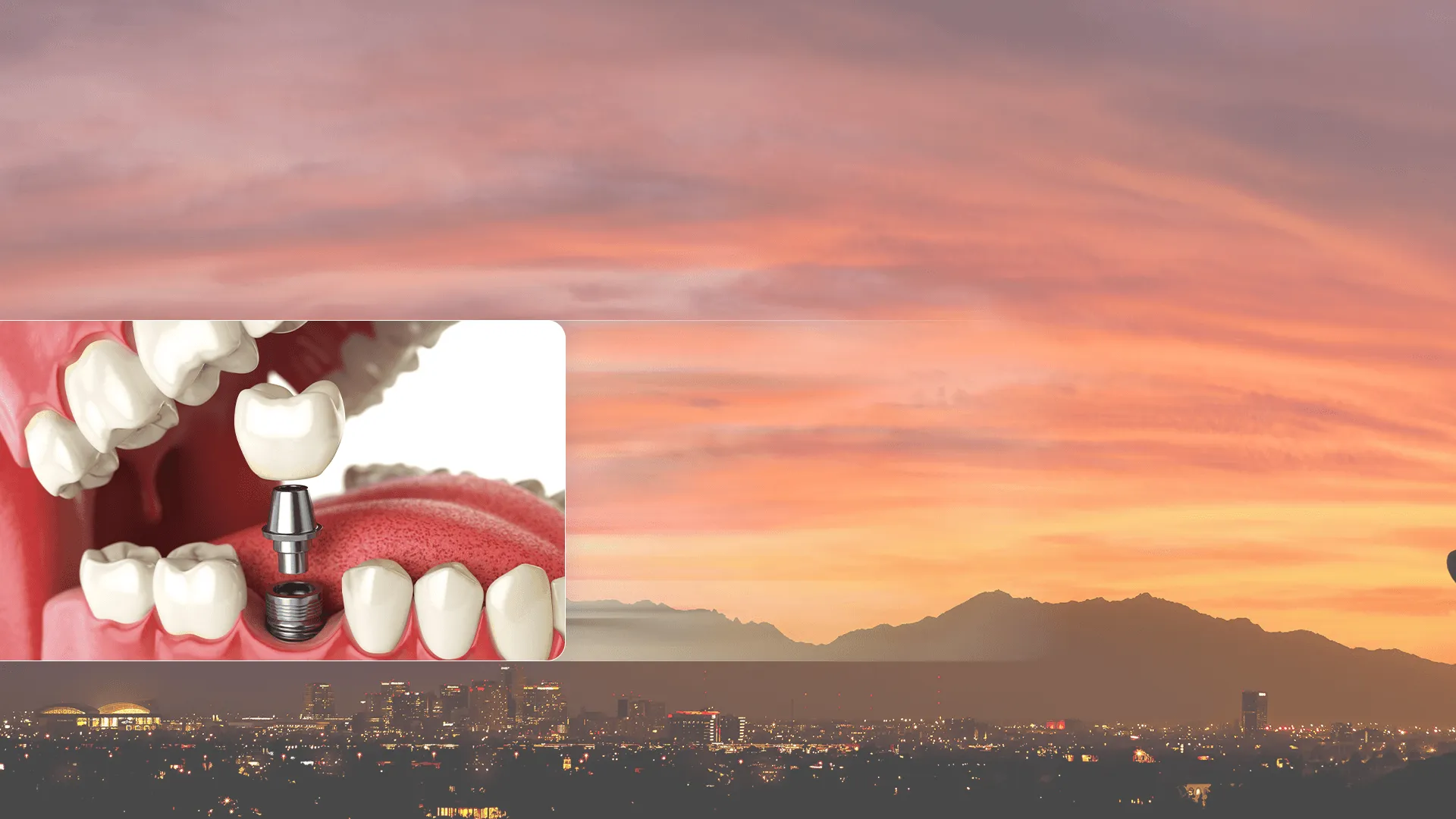 Image of sunset background plus photo of patient at dentist