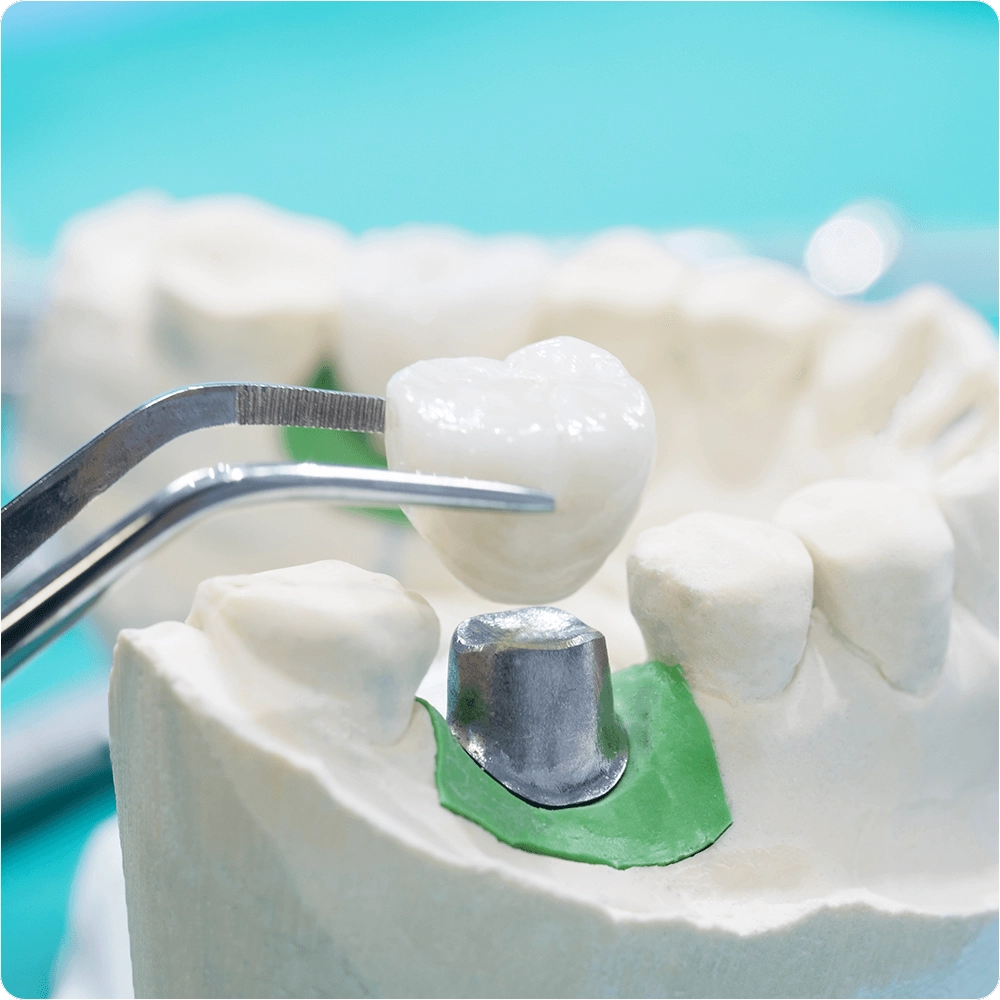 Dental crown photo